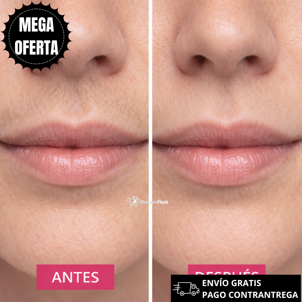 Oferta especial: CYPERUS CONTROL™ - Reduce el Vello y Suaviza la Piel